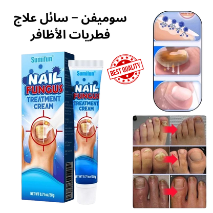 Sumifun Nail Fungus Treatment | Antifungal Liquid for Nail Repair & Clarity