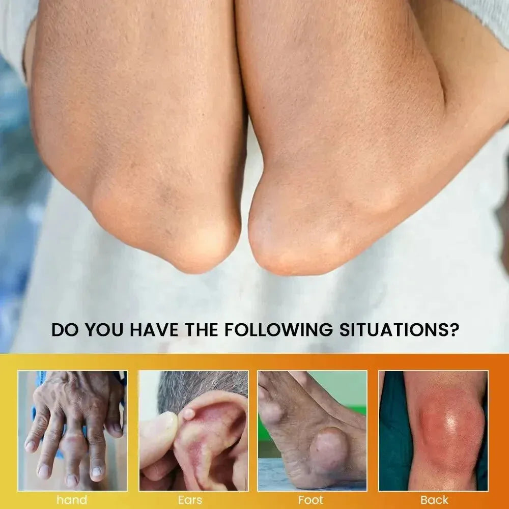 Sumifun - Gout Relief Cream (Original)